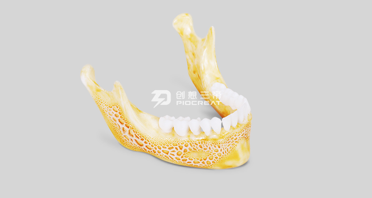 6t体育-齿科3D打印机在齿科领域的应用